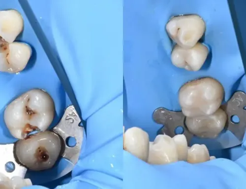 Interviu cu Dr. Anca Mănărăzan – Stomatologie restaurativă și protetică Mb Dental Târgu Mureș
